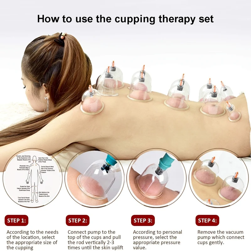 12/24 Pezzi, Set Per Coppettazione, Set Per Coppettazione Hijama Con Pompa, Ventose Per Vuoto Per Corpo Relex, Kit Di Coppettazione Per Massaggio, Terapia Fisica Per Coppettazione Dei Punti Di Agopuntura Cinese