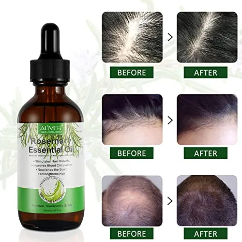 Olio Essenziale di Rosmarino per Capelli Crescita, Rosemary Essential Oil for Hair Growth, per Capelli Secchi e Danneggiati, Stimolano la Crescita dei Capelli, Nutrono Il Cuoio Capelluto, 60 ml