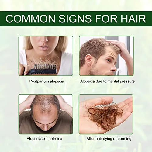 Olio Essenziale di Rosmarino per Capelli Crescita, Rosemary Essential Oil for Hair Growth, per Capelli Secchi e Danneggiati, Stimolano la Crescita dei Capelli, Nutrono Il Cuoio Capelluto, 60 ml